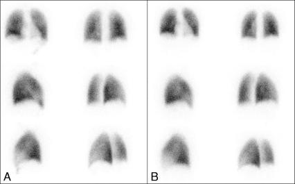 Fig. 132.1 Source : CERF, CNEBMN, 2022.